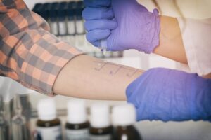 Allergy test in laboratory: probiotics may help