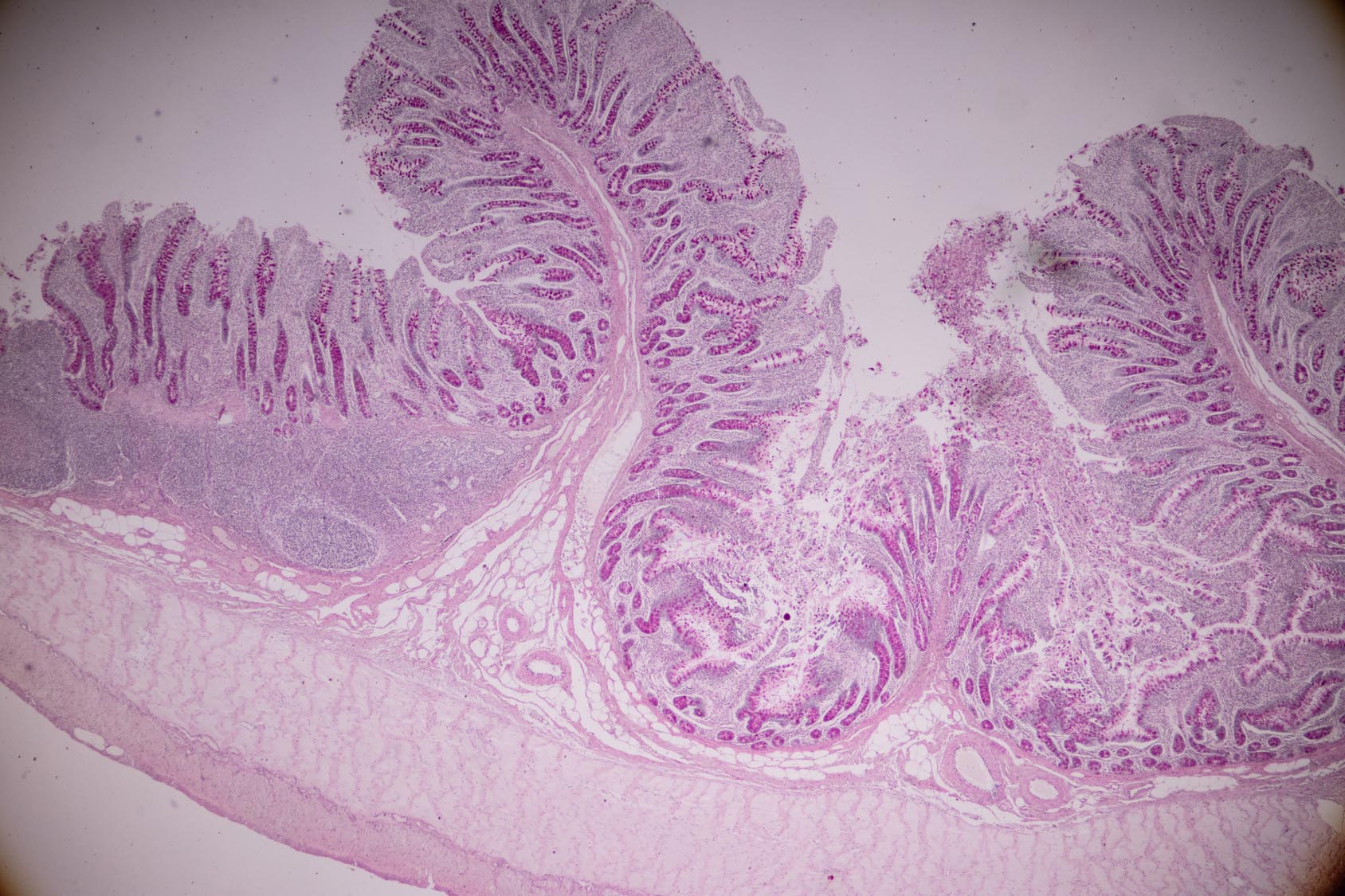 A Better Mouse Model For Inflammatory Bowel Disease