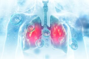 Antibiotics can leave the lungs susceptible to flu virus infections