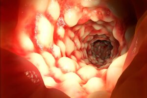 Human metabolites boost the growth of bacteria linked with inflammatory bowel disease