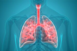 Lung bacteria could help to predict clinical outcomes in critically ill patients