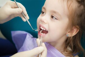 Changes in the oral microbiome might reveal caries development in children