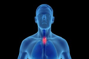 Some oral microbes may influence esophageal cancer risk