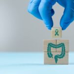 Simple rectal mucus test shows promise for detecting colon cancer 