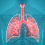 Microbial “fingerprints” in the lungs linked to pneumonia treatment outcomes