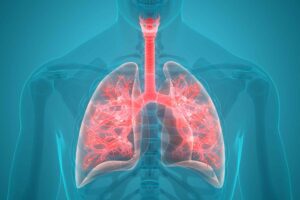 Microbial “fingerprints” in the lungs linked to pneumonia treatment outcomes