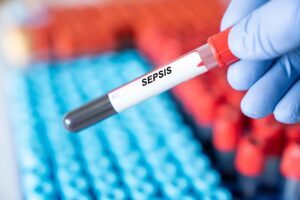 In mice, a ketogenic diet protects the lungs from sepsis via gut bacteria