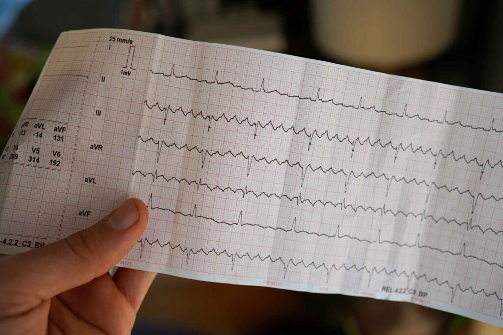 Gut microbe and its metabolite may protect the heart from atrial fibrillation