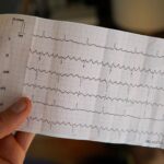 Gut microbe and its metabolite may protect the heart from atrial fibrillation