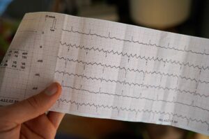 Gut microbe and its metabolite may protect the heart from atrial fibrillation
