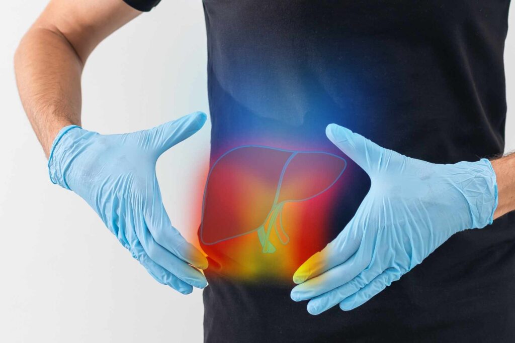 High sugar may promote severe fatty liver disease through gut bacteria