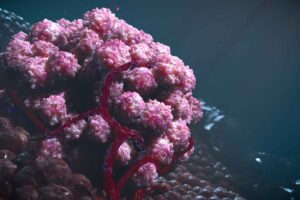 Tumor microbiota differences between men and women offer clues to cancer outcomes