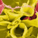 Gut microbes turn low-protein diets into fat-burning beige fat, mice study shows