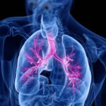 Microbe-sensing immune receptor may help protect against lung fibrosis