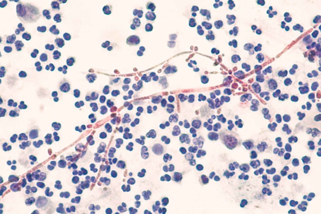 Gut bacteria’s fatty acids may help keep Candida in check