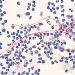 Gut bacteria’s fatty acids may help keep Candida in check